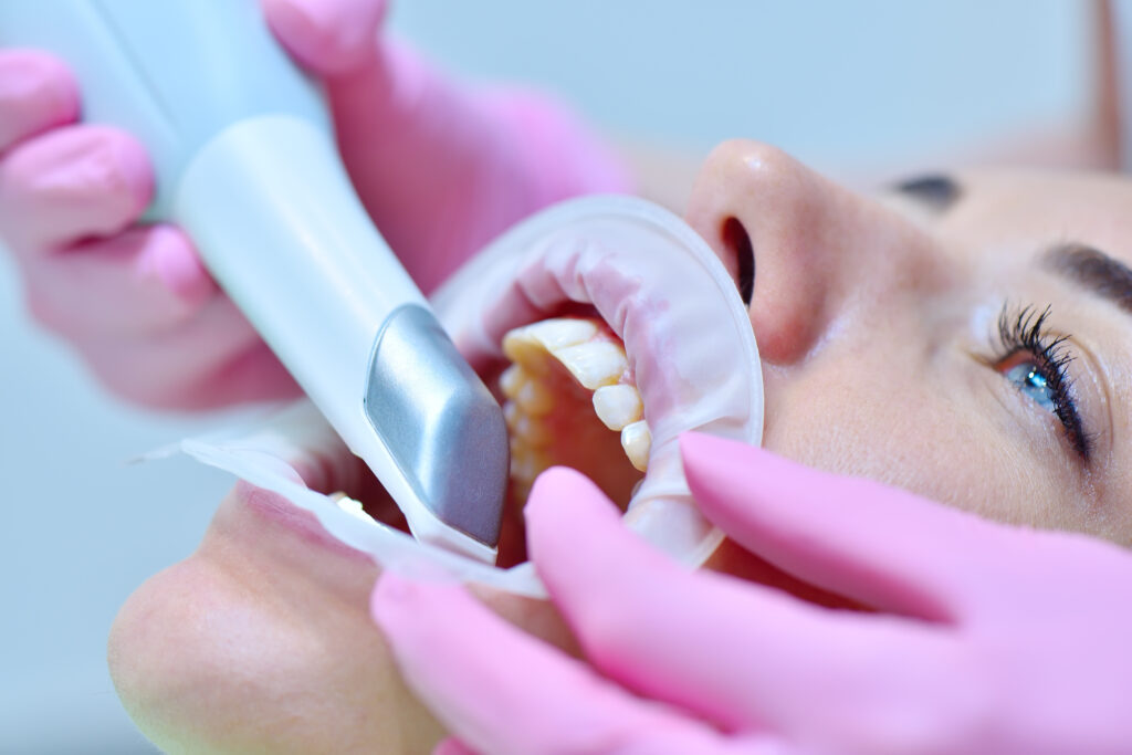 Orthodontist using 3D intraoral scanner for scanning teeth patient's. Modern dental clinic with equipment.  Dentistry and health care concept. Close up